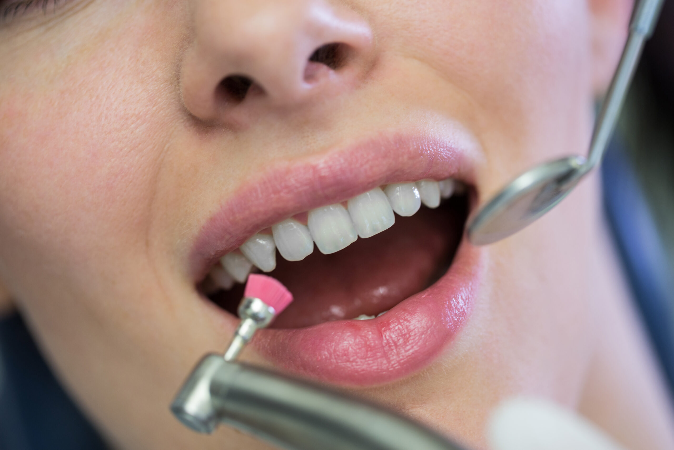 Teeth illustrating professional care related to smile enhancements like Crown Lengthening vs. Gum Contouring in Beverly Hills.