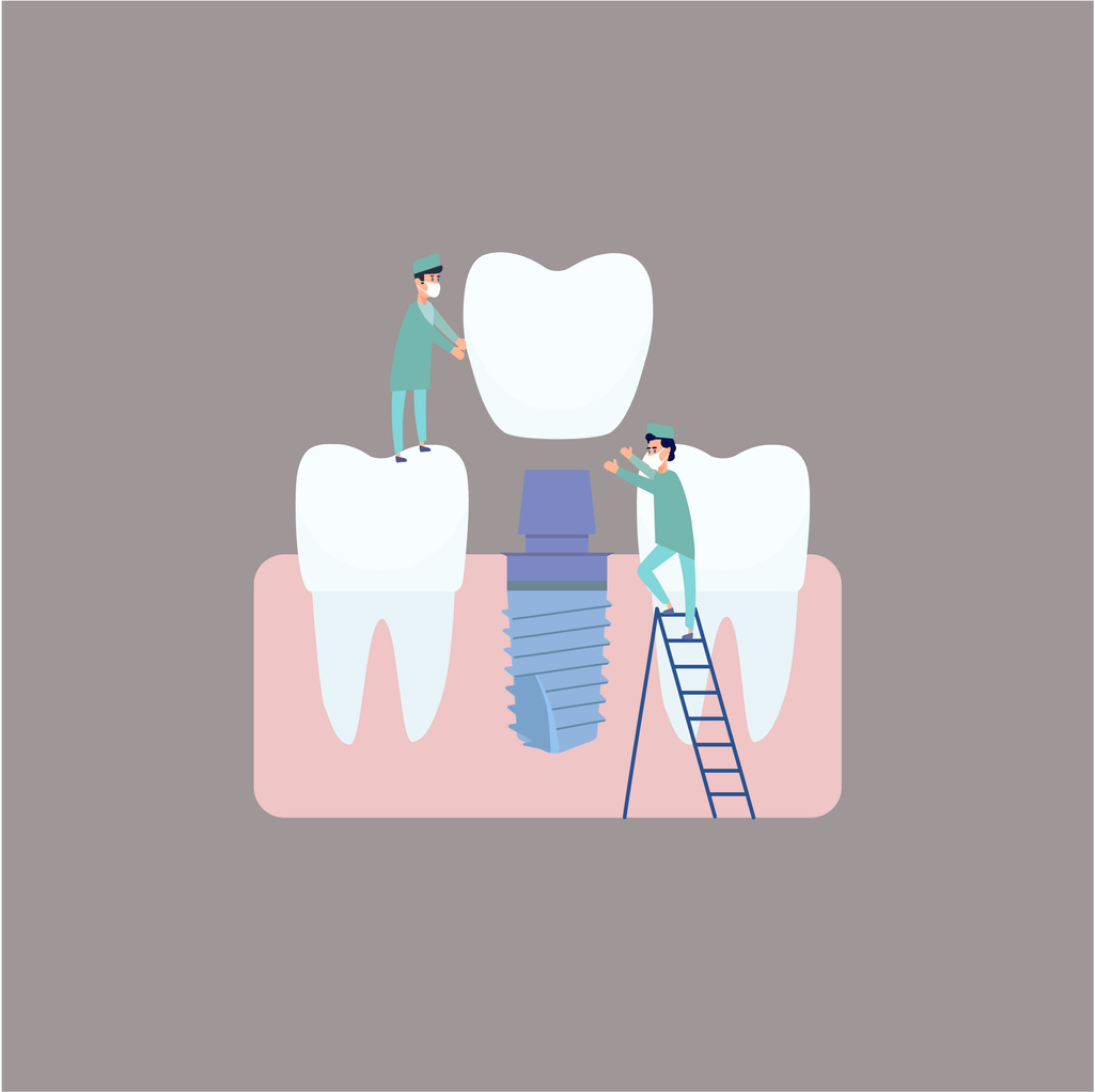 concept image of how dental implants are made