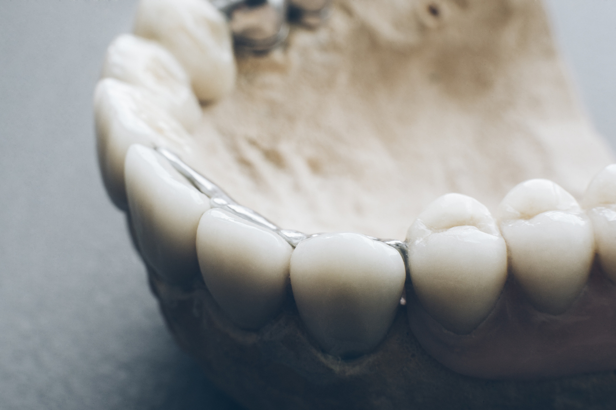 orthodontics prosthetics dental implants gypsum
