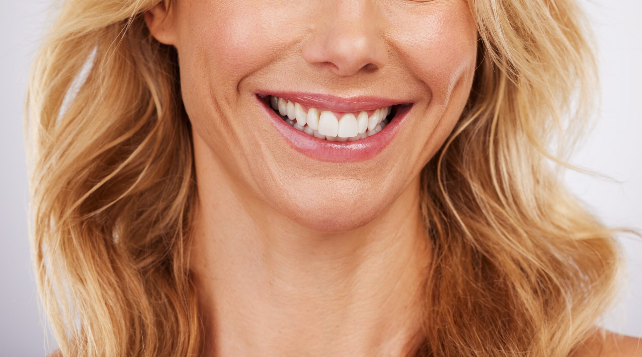 Secret history of porcelain veneers in Beverly Hills
